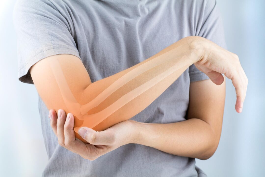 Douleur dans l'articulation du coude et son traitement avec le gel Hondroine